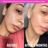 Niacinamide Brightening Toner