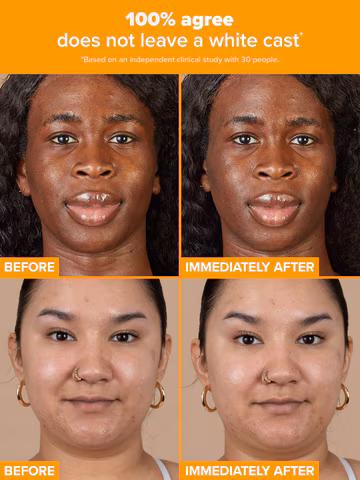 5% Vitamin C Sheer Moisturizer4