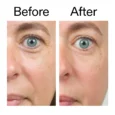 Bio-Active Ceramide Moisturizer2