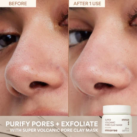 Glow + Brighten Skincare Setsv