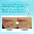 Pantothenic B5 Active Soothing Serum3