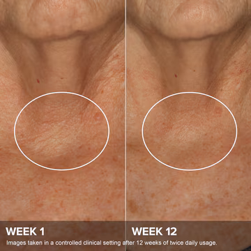 Phytoestrogen Elasticity Renewal Body Treatment2