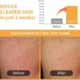 Radiance Glowing Jumbo Essence Pads3