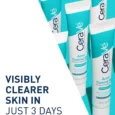 Acne Control Gels