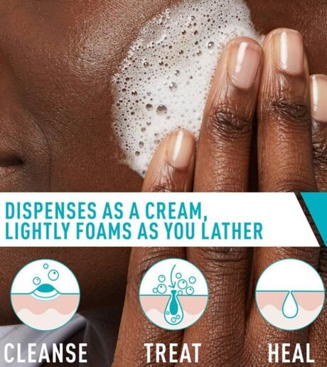 Acne Foaming Cream Cleanserss