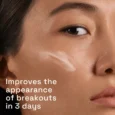 Gentle Clear Triple-Action Acne Serums
