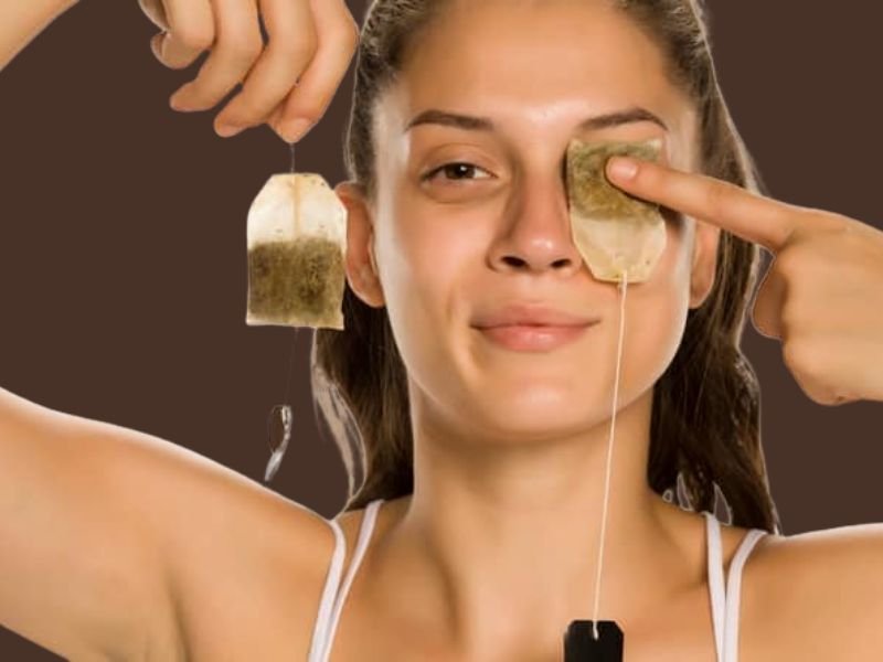 dark circles