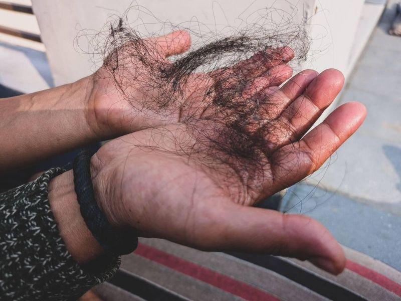 natural treatment for hair loss