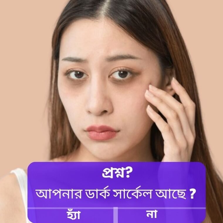 under-eye circles