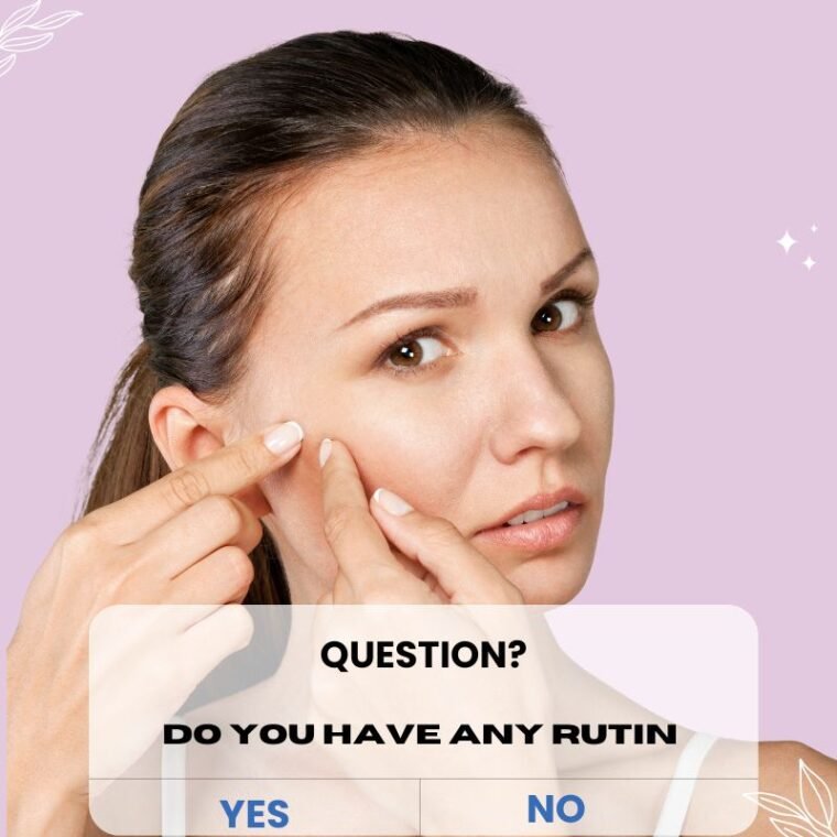 acne prone skin care in Bangla