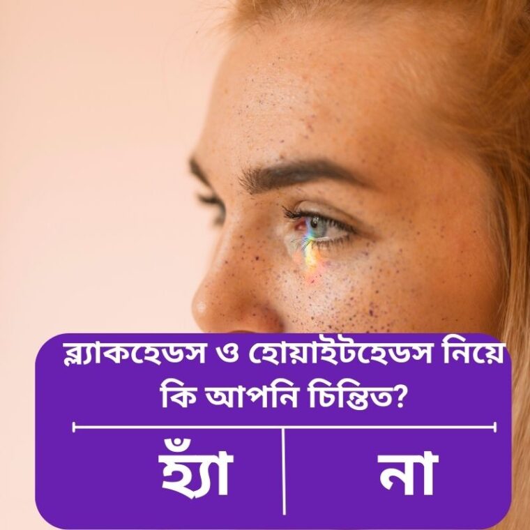 হোয়াইটহেড, ব্ল্যাকহেড ও সিস্টিক একনের পার্থক্য কী? সহজ সমাধানসহ একন পার্থক্য