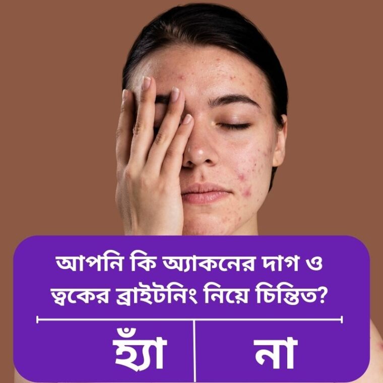 অ্যাকনের দাগ ও ত্বকের ব্রাইটনিংয়ের ঘরোয়া সমাধান: প্রাকৃতিক উপায়
