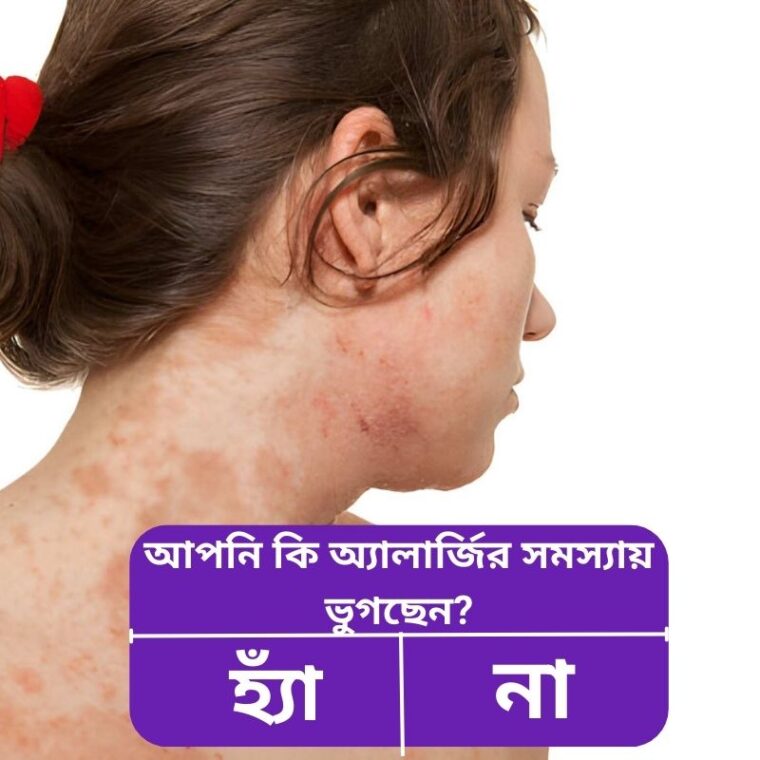 অ্যালার্জি কমানোর ঘরোয়া পদ্ধতি: প্রাকৃতিক ও নিরাপদ গাইড