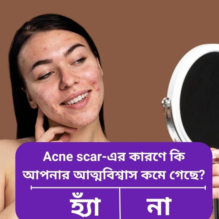 অ্যাকনের দাগ সারাতে কোন পদ্ধতি সবচেয়ে কার্যকর? সম্পূর্ণ গাইড