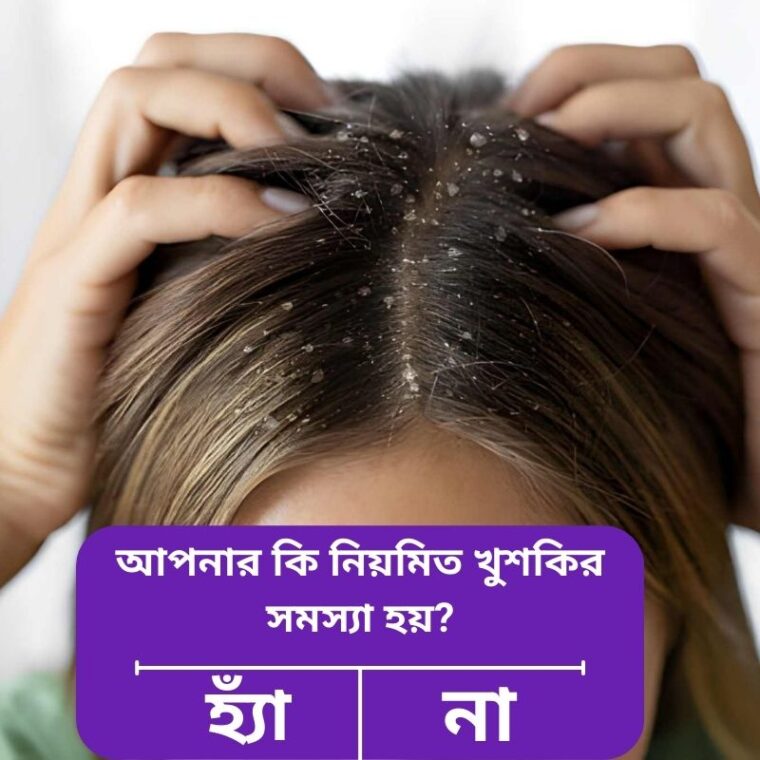 ড্যান্ড্রাফ কেন হয়? খুশকি দূর করার সমাধান ও প্রতিরোধের উপায়