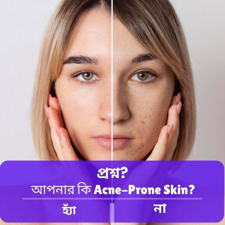 Acne Prone Skin Care Routine: ব্রণপ্রবণ ত্বকের সম্পূর্ণ গাইড
