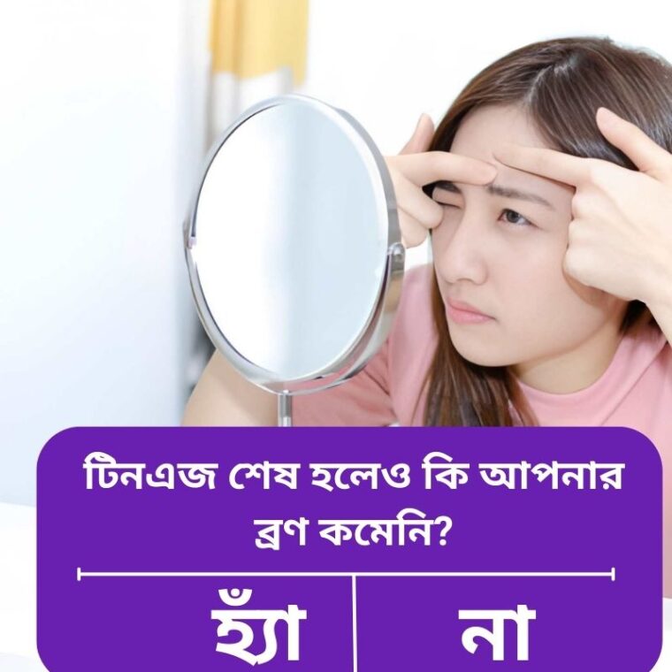 টিনএজ শেষ হলেও ব্রণ কেন থাকে? কারণ ও কার্যকর সমাধান : টিনএজ ব্রণ